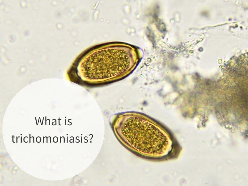 Trichomoniasis Everything You Need To Know