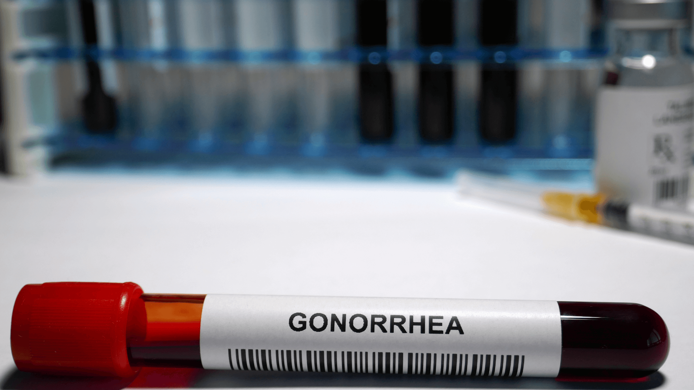 How Does A Gonorrhea Test Work 7957
